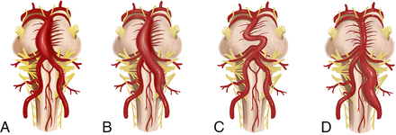 FIG 1.