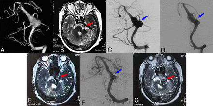 FIG 2.