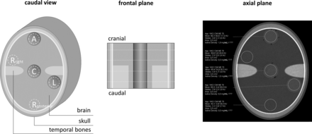 FIG 1.
