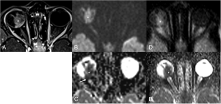 FIG 2.