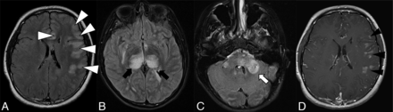 FIG 1.