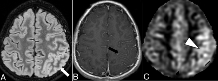 FIG 2.