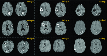 FIG 4.