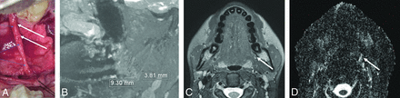 FIG 5.