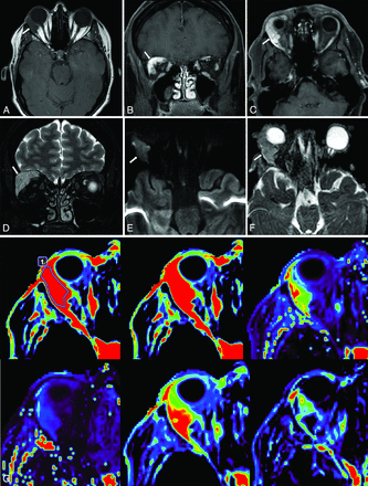 FIG 4.