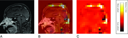 FIG 3.