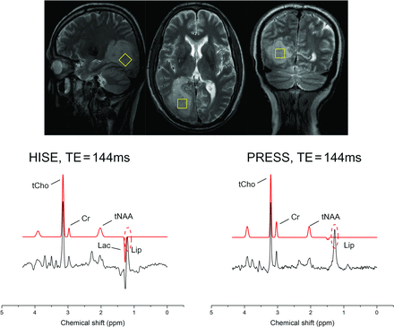 FIG 4.