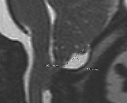 FIG 3.