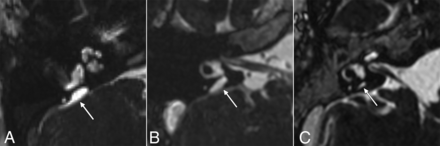 FIG 4.