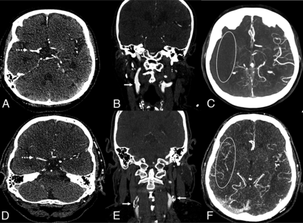 FIG 1.