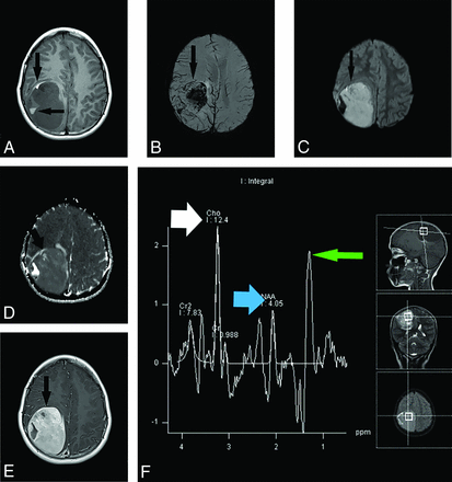 FIG 2.