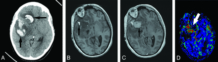 FIG 3.