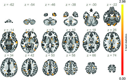 FIG 3.