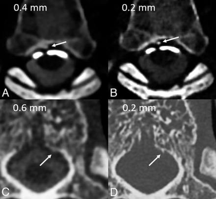 FIG 2.