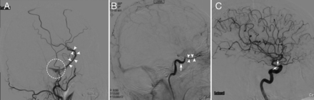 FIG 2.