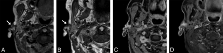 FIG 2.