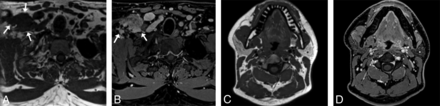 FIG 3.