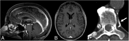FIG 2.