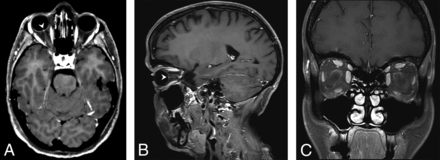 FIG 3.