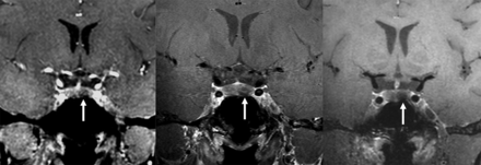 FIG 1.