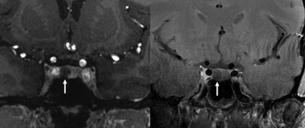 FIG 4.