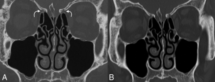 FIG 4.