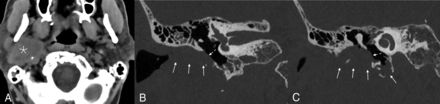 FIG 5.
