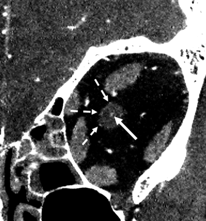 FIG 6.