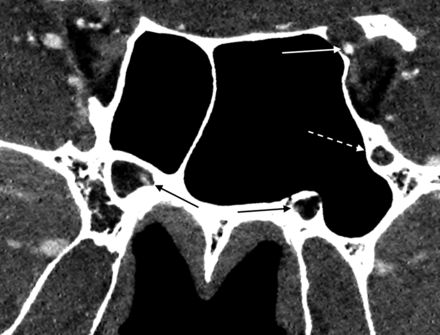 FIG 7.