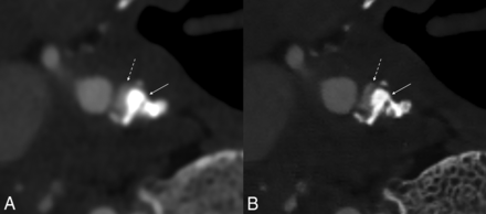 FIG 8.