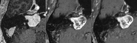 FIG 4.