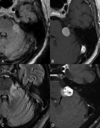 FIG 6.