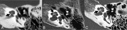 FIG 1.