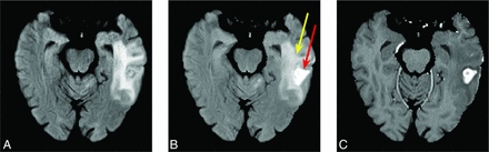 FIG 2.