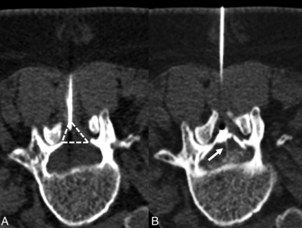 FIG 1.