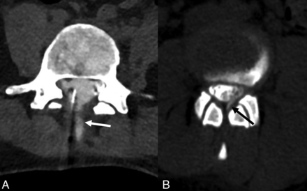 FIG 4.