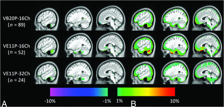 FIG 3.