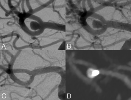 FIG 2.