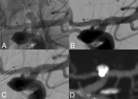 FIG 3.