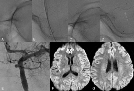 FIG 1.