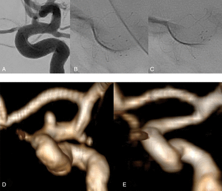 FIG 3.