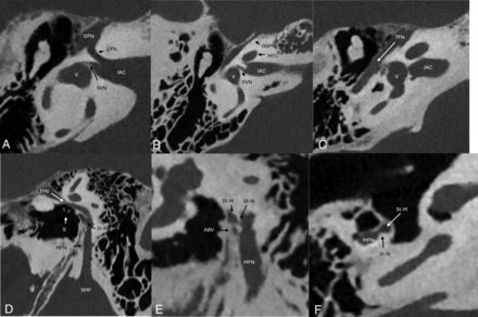 FIG 3.