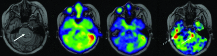 FIG 3.
