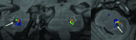 FIG 6.