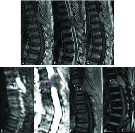 Fig 3.