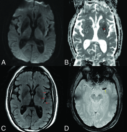 Fig 2.