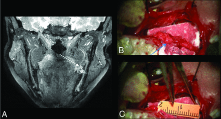 Fig 4.