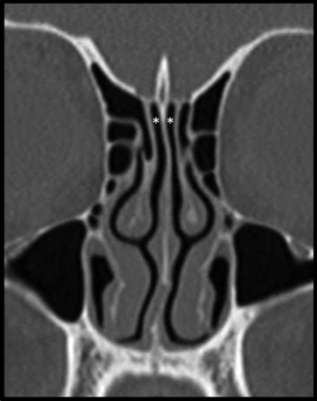 Fig 1.