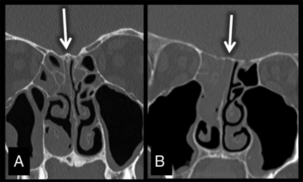 Fig 3.