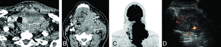 Fig 2.